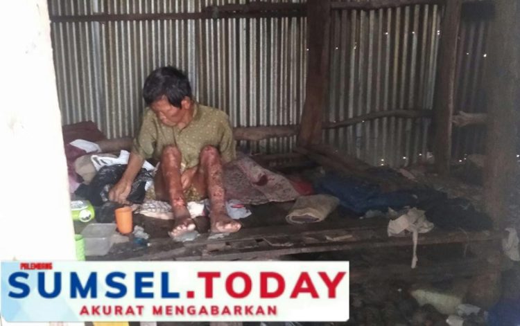 Tragis, Maslan Hidup Sendiri Dengan Kondisi Yang Semakin Memprihatinkan.